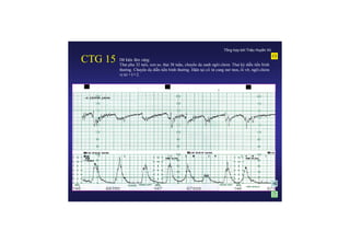 CTG ANL.pdf