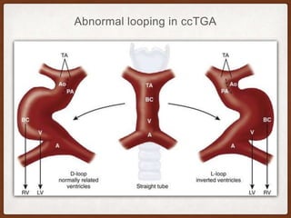 cTGA PPT.pptx