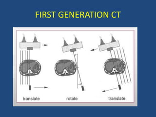 FIRST GENERATION CT
 