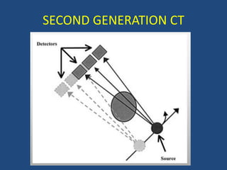 SECOND GENERATION CT
 