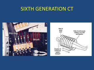 SIXTH GENERATION CT
 