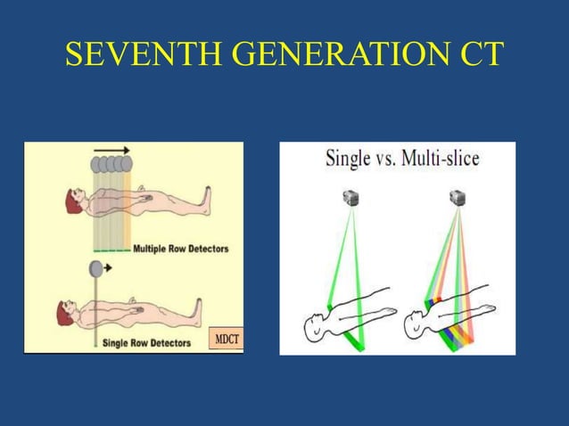 CT Generation Generation Of CT PPTX Medical Tests Medical Health