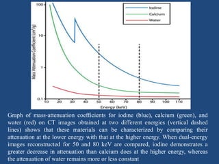 Graph of mass-attenuation coefficients for iodine (blue), calcium (green), and
water (red) on CT images obtained at two different energies (vertical dashed
lines) shows that these materials can be characterized by comparing their
attenuation at the lower energy with that at the higher energy. When dual-energy
images reconstructed for 50 and 80 keV are compared, iodine demonstrates a
greater decrease in attenuation than calcium does at the higher energy, whereas
the attenuation of water remains more or less constant
 
