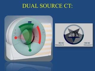 DUAL SOURCE CT:
 