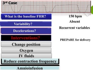 Electronic Fetal Heart Rate Monitoring for Nursing students | PDF
