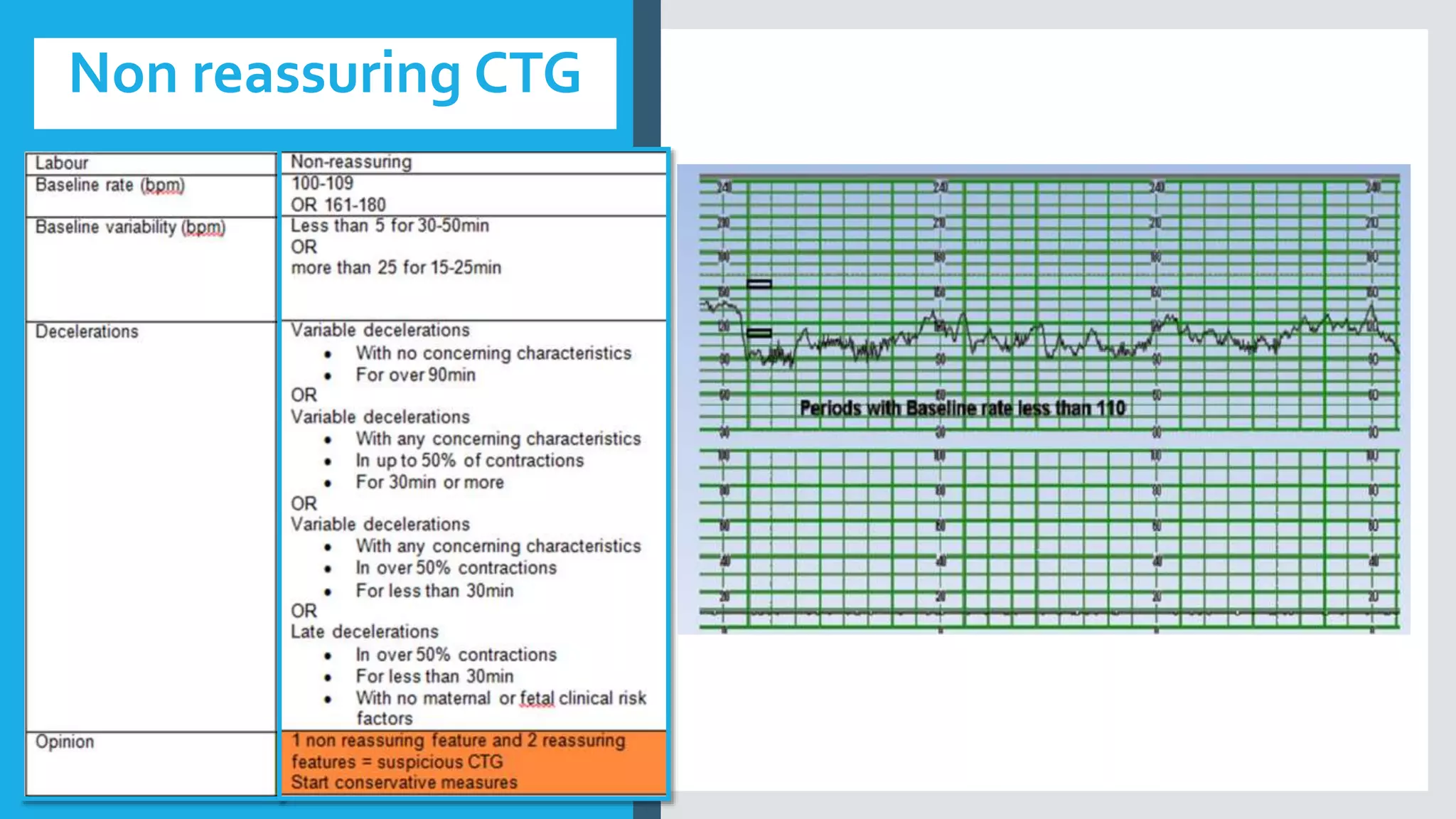 Non reassuring CTG
 
