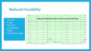 ReducedVariability
• Hypoxia
• Drugs
• Extreme
prematurity
• Sleep
• CNS abnormality.
 