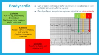 Bradycardia
3 6 9
3 minutes
Call obs reg, anaesthetist,
theatre team
Start Conservative measures
Ask for terbutaline
6 minutes
Prepare woman for theatre /
instrumental
Continue conservative
measures
9 minutes
Transfer to theatre and
expedite birth
■ 95% of babies will recover before 9 minutes in the absence of cord
prolapse, abruption, uterine rupture
■ If cord prolapse, abruption or rupture – expedite birth immediately
 