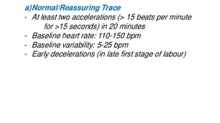 Ctg interpretation and mangment