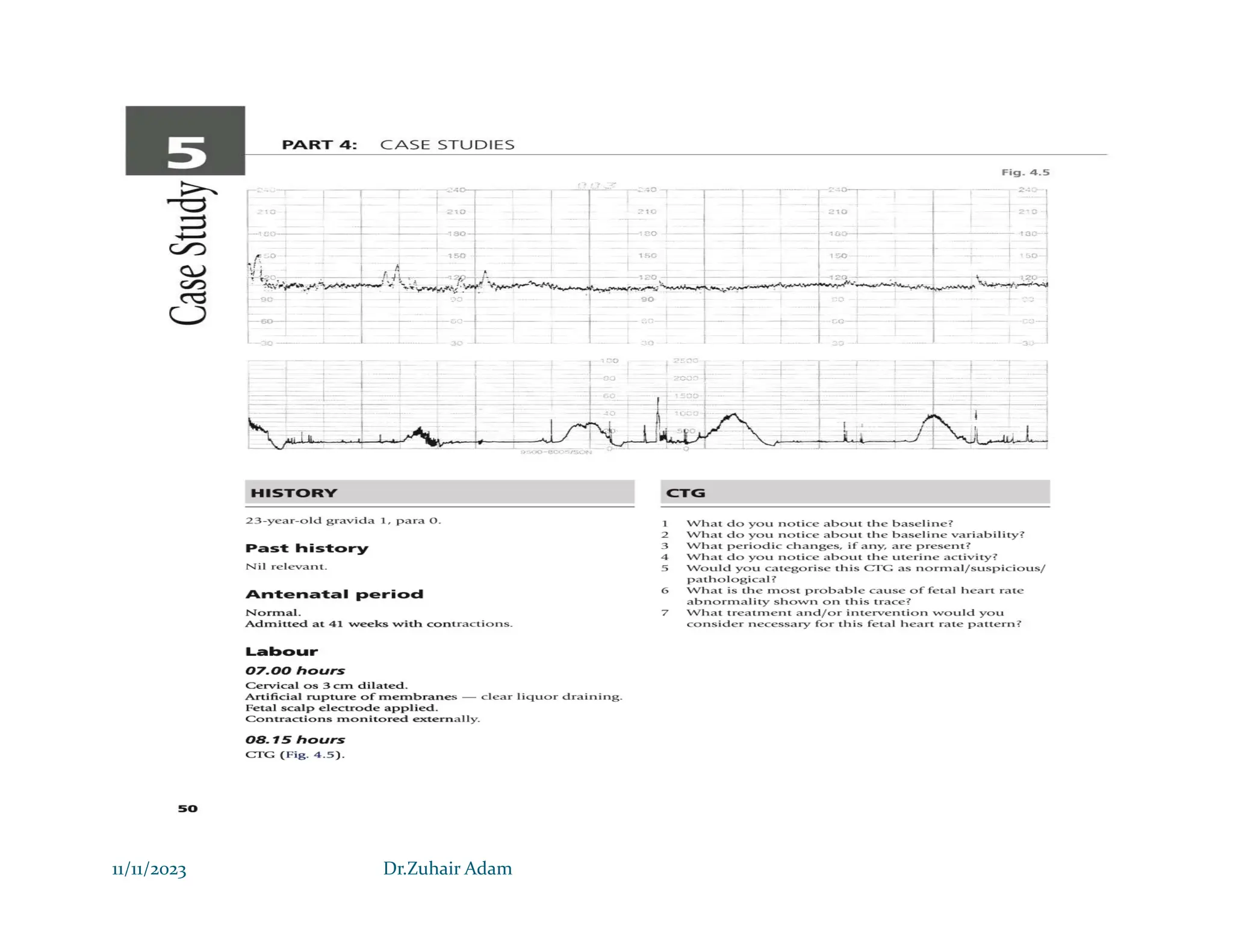 Nice Ctg Interpretation Guide.pdf CTG INTERPRETATION Dr zuhair 2023.pdf