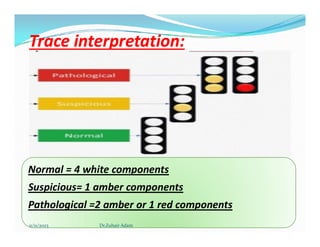 Trace interpretation:
Trace interpretation:
Normal = 4 white components
Suspicious= 1 amber components
Pathological =2 amber or 1 red components
11/11/2023 Dr.Zuhair Adam
 