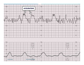 11/11/2023 Dr.Zuhair Adam
 