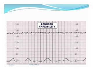 11/11/2023 Dr.Zuhair Adam
 