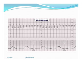 11/11/2023 Dr.Zuhair Adam
 