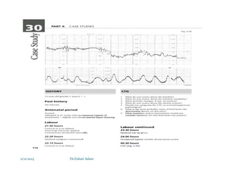 11/11/2023 Dr.Zuhair Adam
 