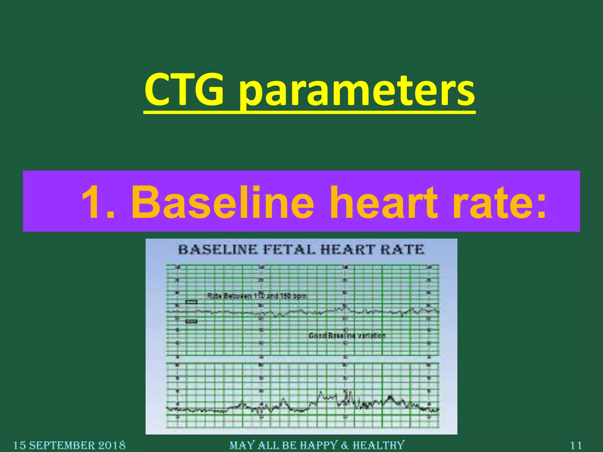 15 September 2018 May All Be Happy & Healthy 11
1. Baseline heart rate:
CTG parameters
 