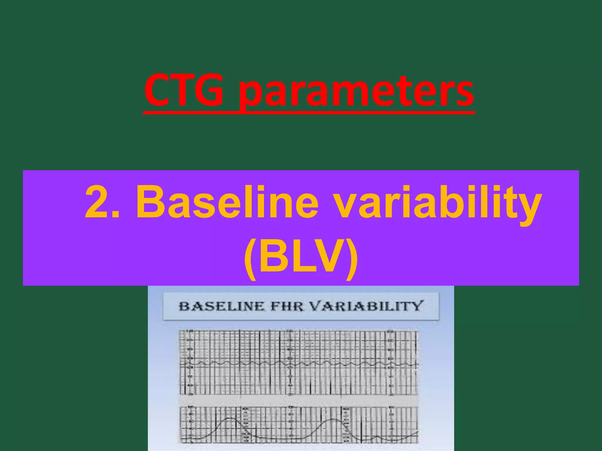 2. Baseline variability
(BLV)
CTG parameters
 
