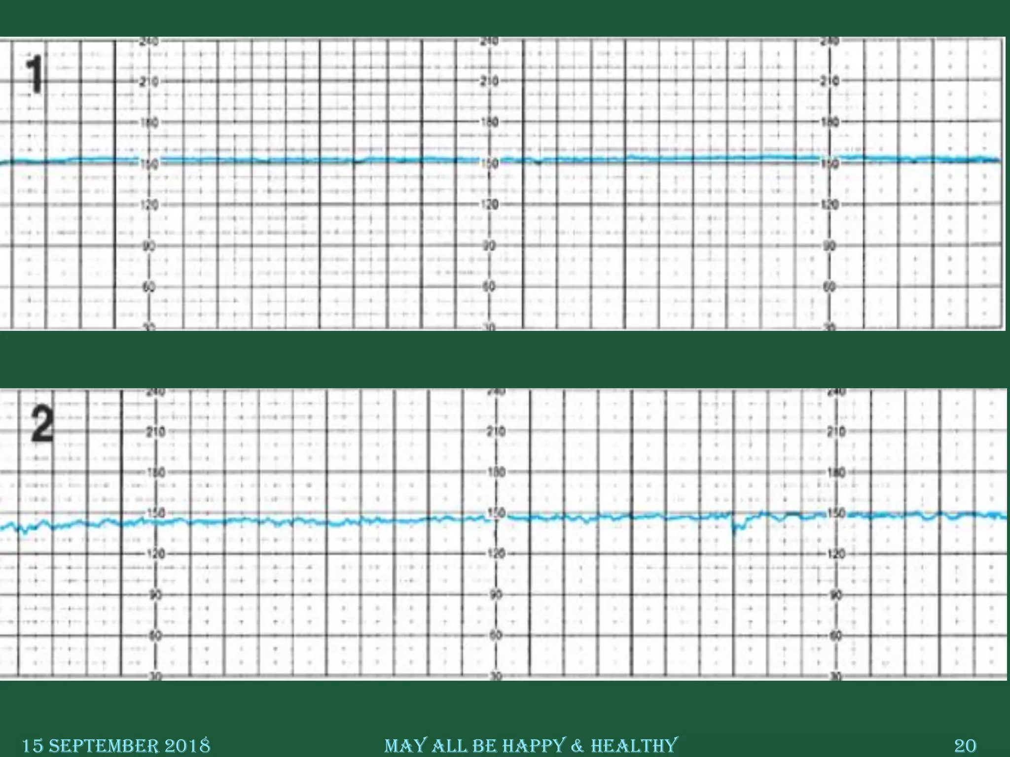 15 September 2018 May All Be Happy & Healthy 20
 