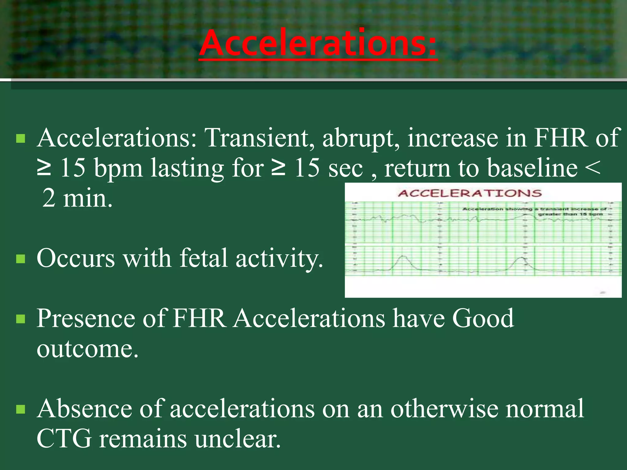 Accelerations:
 Accelerations: Transient, abrupt, increase in FHR of
≥ 15 bpm lasting for ≥ 15 sec , return to baseline <
2 min.
 Occurs with fetal activity.
 Presence of FHR Accelerations have Good
outcome.
 Absence of accelerations on an otherwise normal
CTG remains unclear.
 
