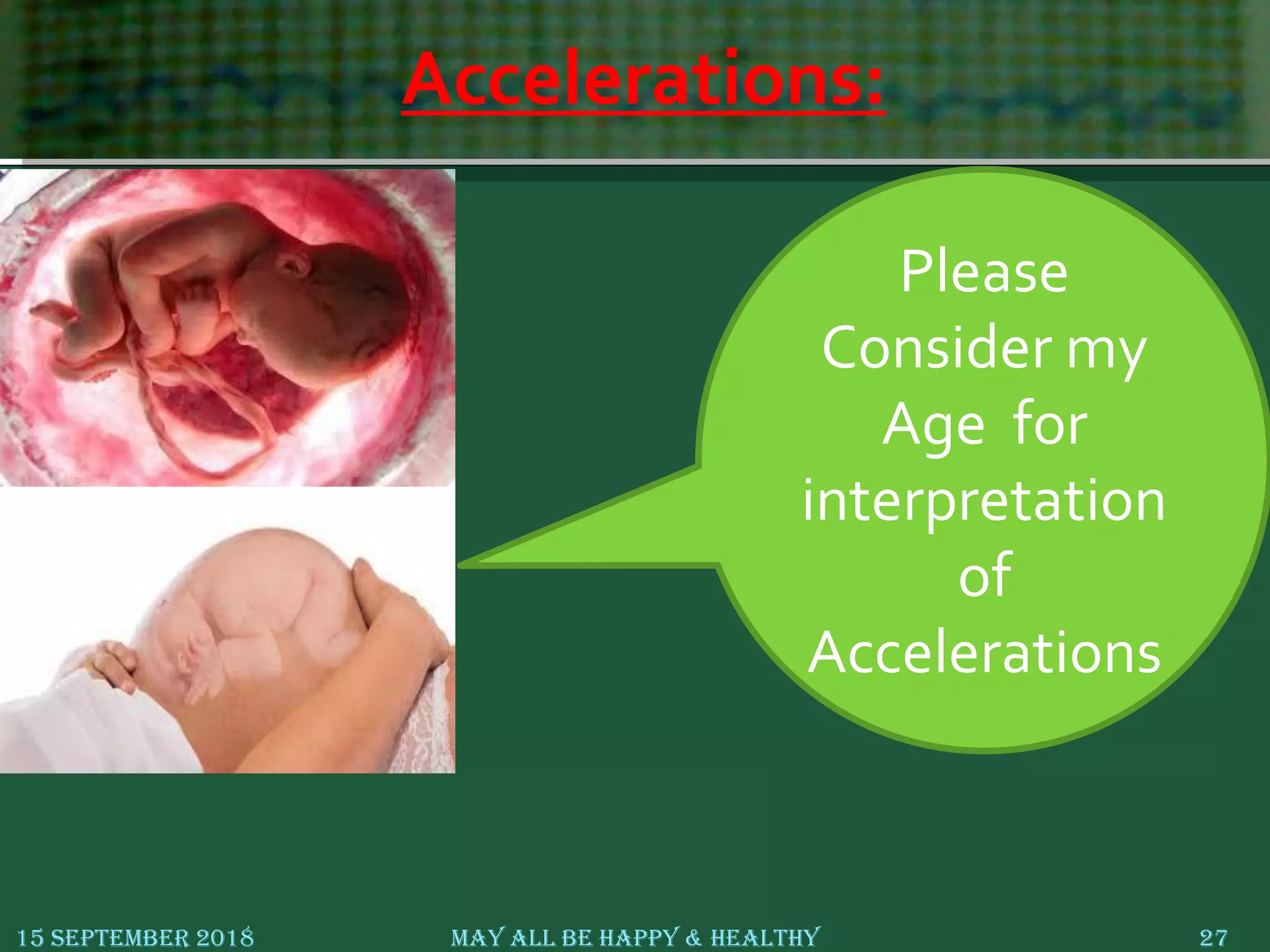 Accelerations:
15 September 2018 May All Be Happy & Healthy 27
Please
Consider my
Age for
interpretation
of
Accelerations
 