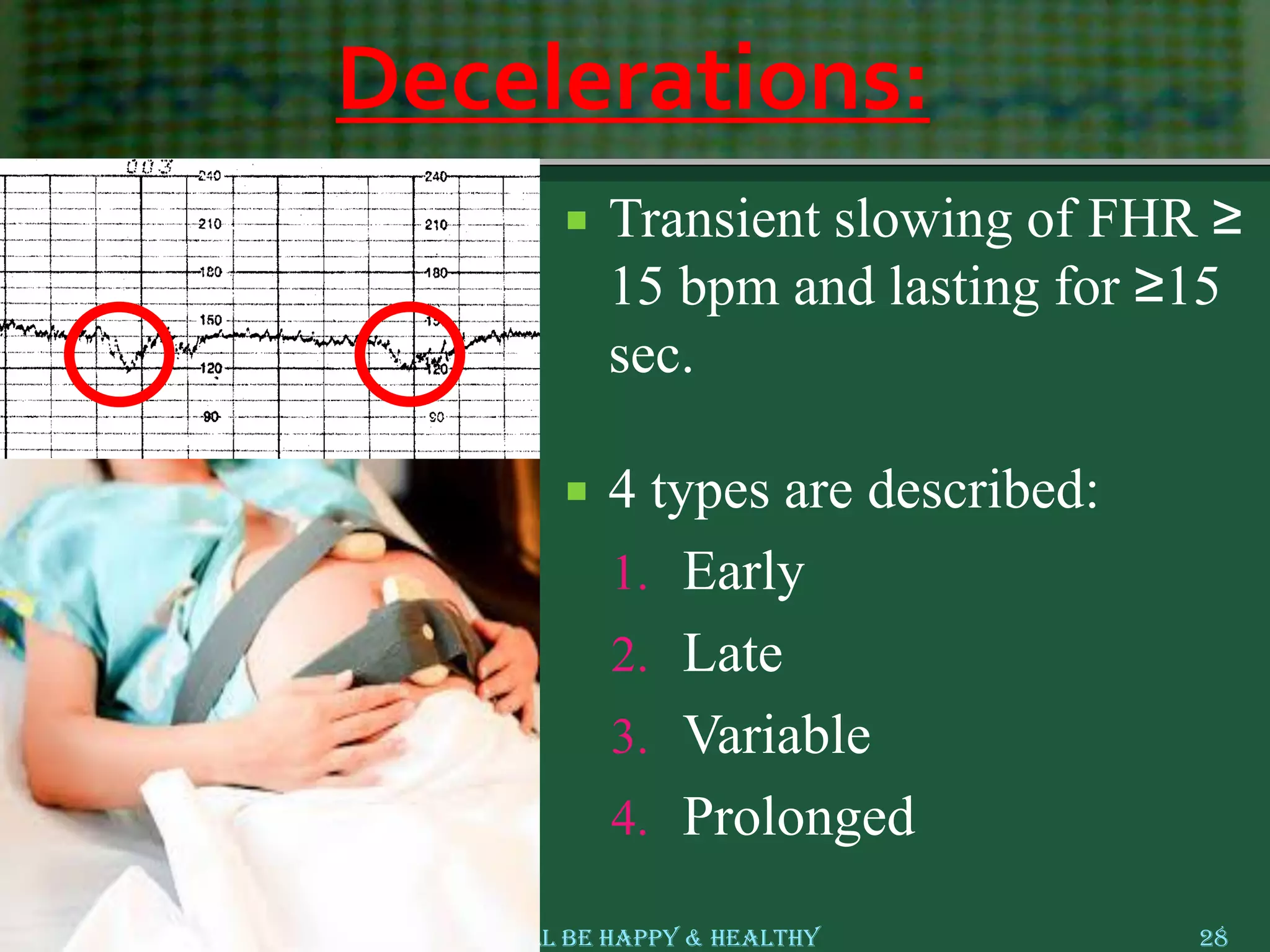 Decelerations:
 Transient slowing of FHR ≥
15 bpm and lasting for ≥15
sec.
 4 types are described:
1. Early
2. Late
3. Variable
4. Prolonged
15 September 2018 May All Be Happy & Healthy 28
 
