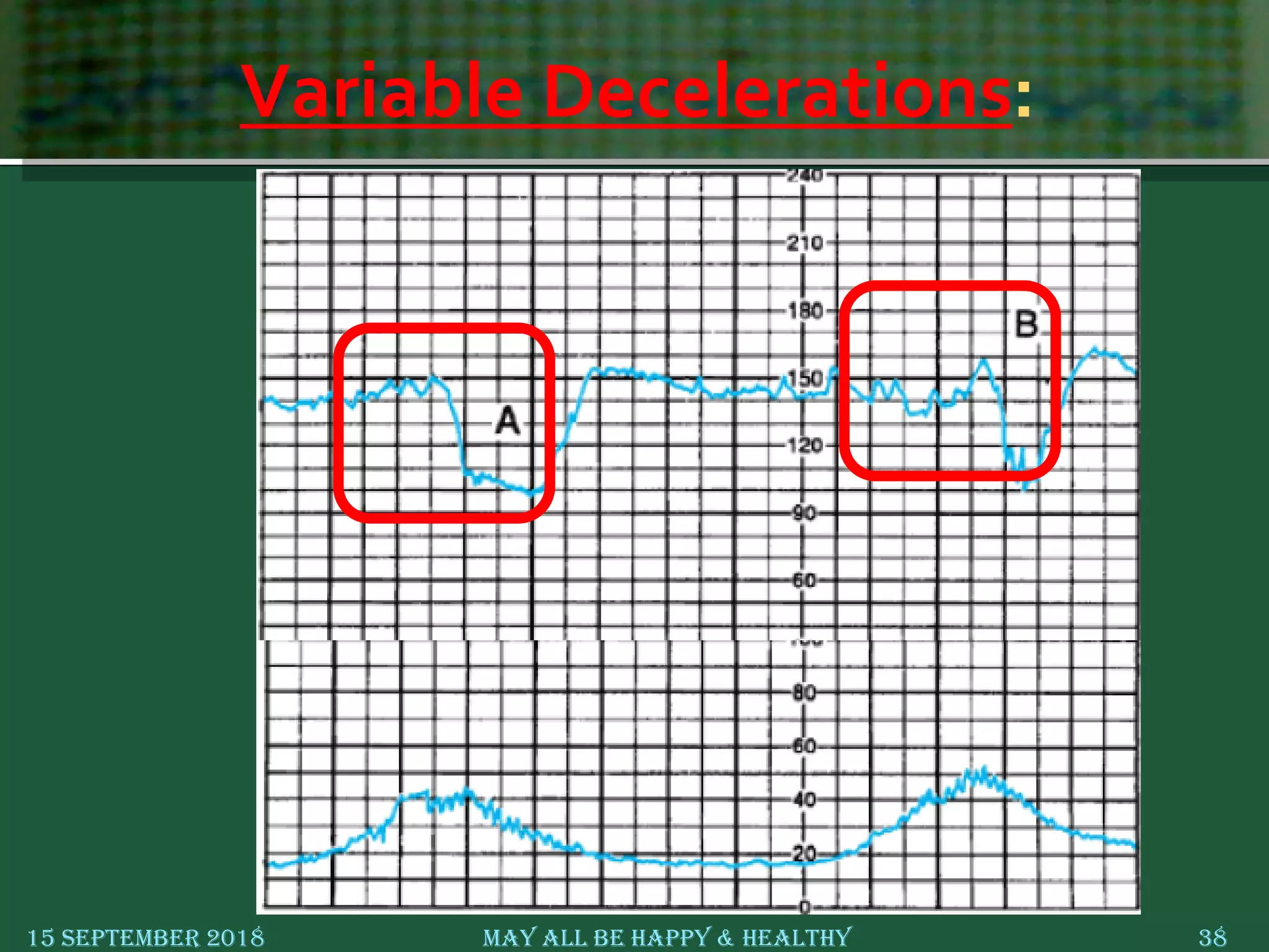 Variable Decelerations:
15 September 2018 May All Be Happy & Healthy 38
 