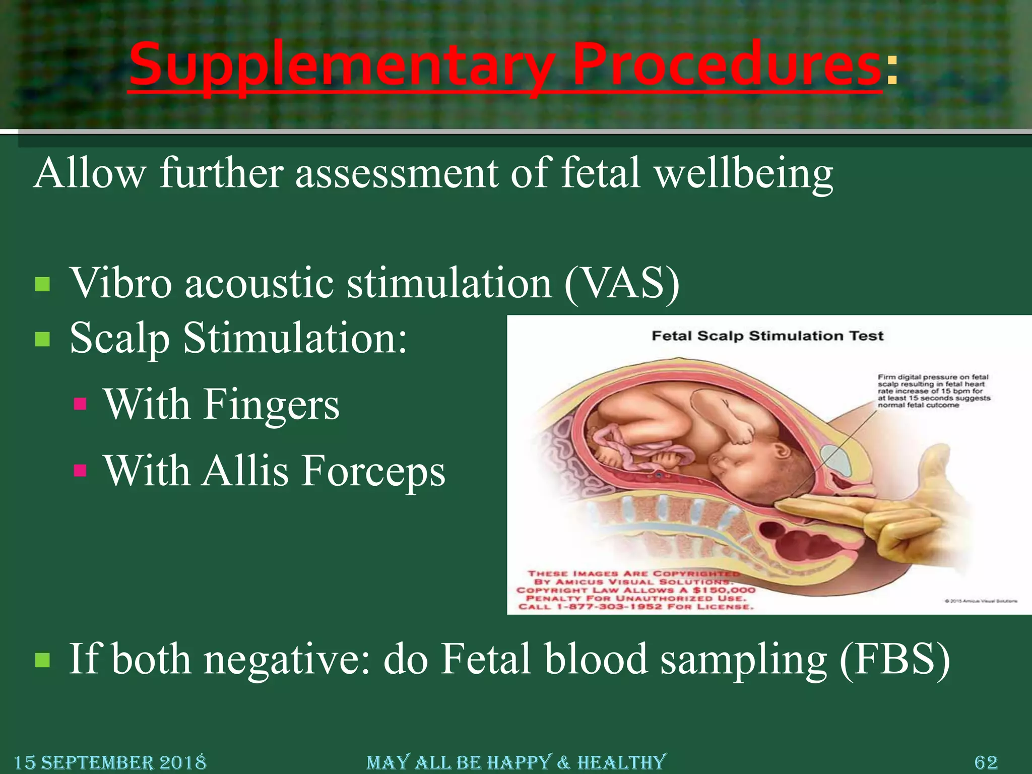 Supplementary Procedures:
Allow further assessment of fetal wellbeing
 Vibro acoustic stimulation (VAS)
 Scalp Stimulation:
 With Fingers
 With Allis Forceps
 If both negative: do Fetal blood sampling (FBS)
15 September 2018 May All Be Happy & Healthy 62
 