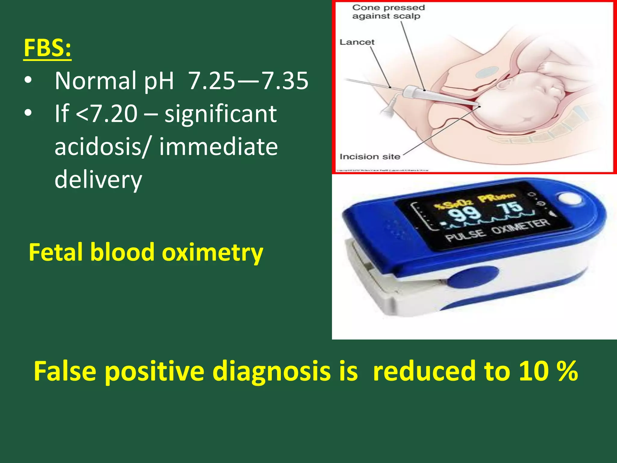 FBS:
• Normal pH 7.25—7.35
• If <7.20 – significant
acidosis/ immediate
delivery
Fetal blood oximetry
False positive diagnosis is reduced to 10 %
 
