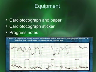 CTG Monitoring | PPT