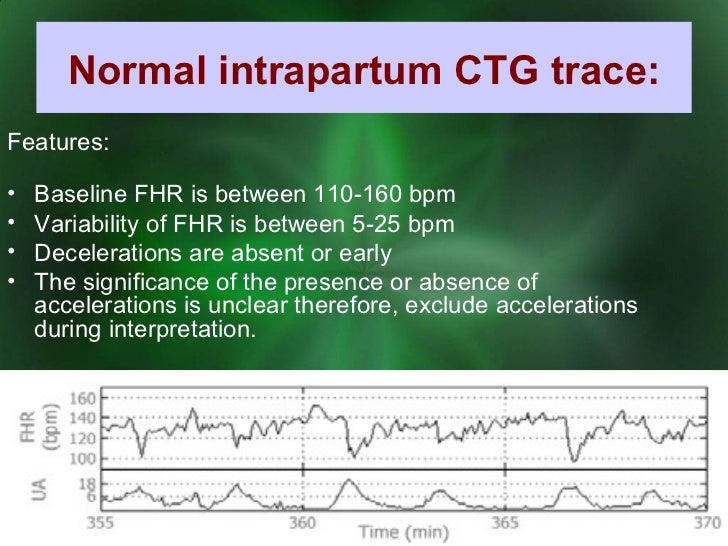 CTG Monitoring
