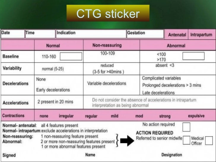 CTG Monitoring