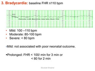 3. Bradycardia: baseline FHR ≤110 bpm
• Mild: 100 –110 bpm
• Moderate: 80-100 bpm
• Severe: < 80 bpm
Mild: not associated with poor neonatal outcome.
Prolonged: FHR < 100/ min for 3 min or
< 80 for 2 min
Aboubakr Elnashar
 