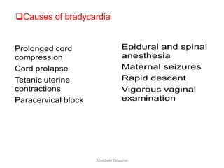 Causes of bradycardia
Aboubakr Elnashar
 