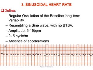 3. SINUSOIDAL HEART RATE
Define:
– Regular Oscillation of the Baseline long-term
Variability
– Resembling a Sine wave, with no BTBV.
– Amplitude: 5-15bpm
– 2- 5 cycle/m
– Absence of accelerations
Aboubakr Elnashar
 