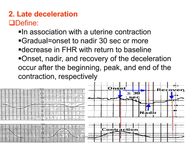 CTG: patterns | PDF