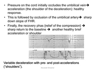 • Pressure on the cord initially occludes the umbilical vein
acceleration (the shoulder of the deceleration): healthy
response.
• This is followed by occlusion of the umbilical artery sharp
down slope of FHR.
• Finally, the recovery phas {relief of the compression} 
sharp return to the baseline  another healthy brief
acceleration or shoulder
Variable deceleration with pre- and post-accelerations
(―shoulders‖). Aboubakr Elnashar
 