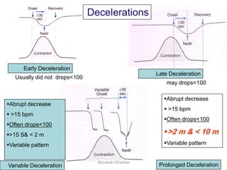 Early Deceleration
Late Deceleration
Variable Deceleration
Abrupt decrease
 >15 bpm
Often drops<100
>15 S& < 2 m
Variable pattern
Abrupt decrease
 >15 bpm
Often drops<100
>2 m & < 10 m
Variable pattern
Prolonged Deceleration
may drops<100
Usually did not drops<100
Decelerations
Aboubakr Elnashar
 