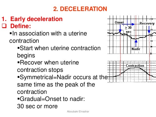 decelerate definition decelerate definition