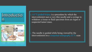 o A CT-guided biopsy is a procedure by which the
interventionist uses a very thin needle and a syringe to
withdraw a tissue or fluid specimen from an organ or
suspected tumor mass.
o The needle is guided while being viewed by the
interventionist on a computed tomography (CT) scan
 