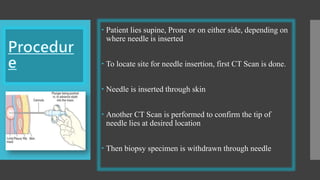  Patient lies supine, Prone or on either side, depending on
where needle is inserted
 To locate site for needle insertion, first CT Scan is done.
 Needle is inserted through skin
 Another CT Scan is performed to confirm the tip of
needle lies at desired location
 Then biopsy specimen is withdrawn through needle
 