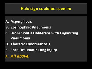 Halo sign could be seen in:
A. Aspergillosis
B. Eosinophilic Pneumonia
C. Bronchiolitis Obliterans with Organizing
Pneumonia
D. Thoracic Endometriosis
E. Focal Traumatic Lung Injury
F. All above.
11
 