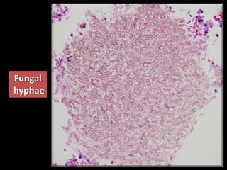 Fungal
hyphae
 