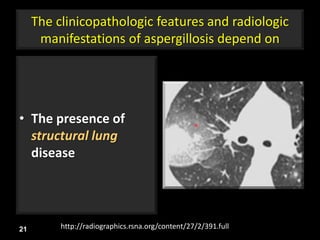 The clinicopathologic features and radiologic
manifestations of aspergillosis depend on
• The presence of
structural lung
disease
21 http://radiographics.rsna.org/content/27/2/391.full
 