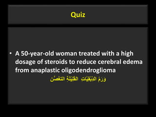 Quiz
• A 50-year-old woman treated with a high
dosage of steroids to reduce cerebral edema
from anaplastic oligodendroglioma
ِ‫ة‬َ‫ل‬ْ‫ي‬ِ‫ل‬َ‫ق‬‫ال‬‫ن‬ُّ‫ص‬َ‫غ‬‫الت‬ ُ‫م‬َ‫ر‬َ‫و‬ِ‫ت‬‫ا‬َّ‫ي‬ِ‫ق‬ْ‫ب‬ِ‫الد‬
23
 