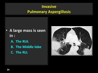 Invasive
Pulmonary Aspergillosis
• A large mass is seen
in :
A. The RUL
B. The Middle lobe
C. The RLL
24
 