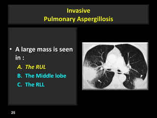 Invasive
Pulmonary Aspergillosis
• A large mass is seen
in :
A. The RUL
B. The Middle lobe
C. The RLL
25
 