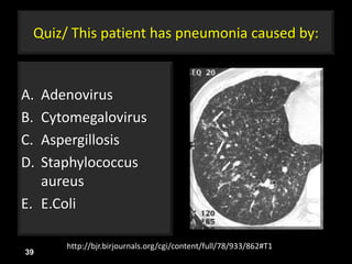 Quiz/ This patient has pneumonia caused by:
A. Adenovirus
B. Cytomegalovirus
C. Aspergillosis
D. Staphylococcus
aureus
E. E.Coli
39
http://bjr.birjournals.org/cgi/content/full/78/933/862#T1
 