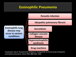 Eosinophilic Pneumonia
Eosinophilic lung
disease may
occur in various
conditions
Parasitic infection
Idiopathic pulmonary fibrosis
Sarcoidosis
Collagen vascular
disease
Hypereosinophilic
syndrome
Drug reactions
51
HayakawaH, Sato A, Toyoshima M, Imokawa S, Taniguchi M. A clinical study of idiopathic
eosinophilic pneumonia. Chest 1994; 105:1462–1466.
 