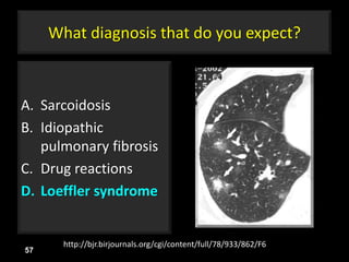 What diagnosis that do you expect?
A. Sarcoidosis
B. Idiopathic
pulmonary fibrosis
C. Drug reactions
D. Loeffler syndrome
57
http://bjr.birjournals.org/cgi/content/full/78/933/862/F6
 