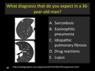 What diagnosis that do you expect in a 36-
year-old man?
A. Sarcoidosis
B. Eosinophilic
pneumonia
C. Idiopathic
pulmonary fibrosis
D. Drug reactions
E. Lupus
61 http://radiographics.rsna.org/content/27/2/391/F26.expansion.html
 